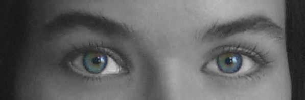 Memphis Plastic Surgery, Eye, Dr. Aldea, Dr. Eby
