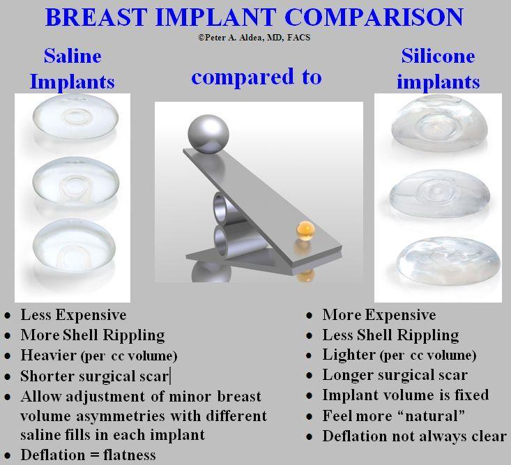 Saline Vs Silicone Gel Implants 80