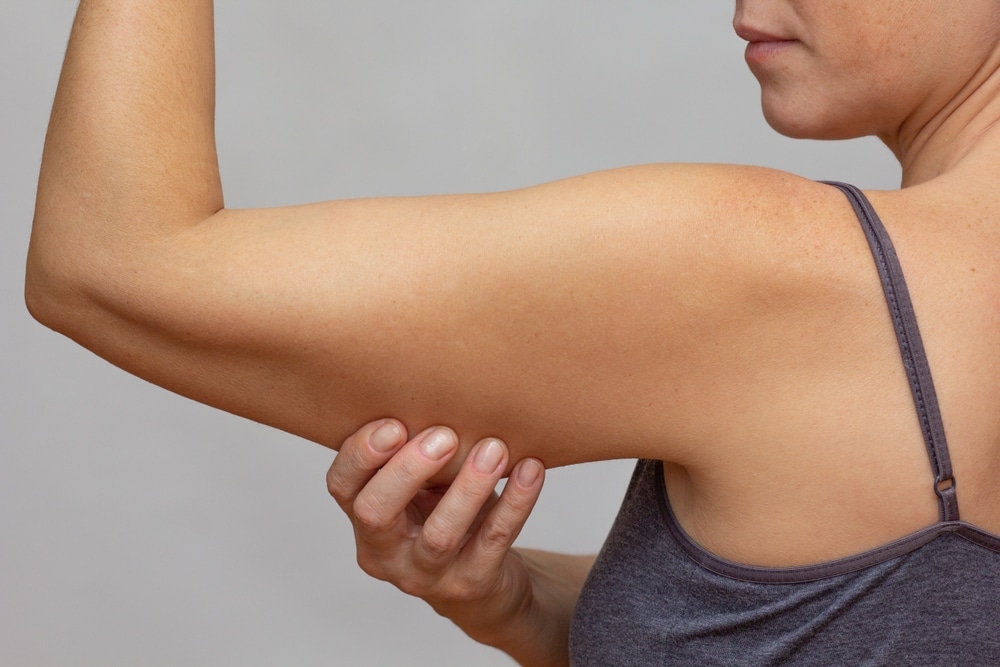 Cropped,Woman,Body,Showing,Arm,With,Sagging,Skin,On,Grey