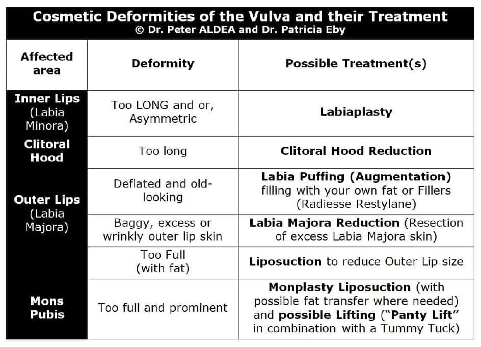 Memphis Designer Vagina specialist, Memphis Labiaplasty Specialist, Vaginal Cosmetic Surgery