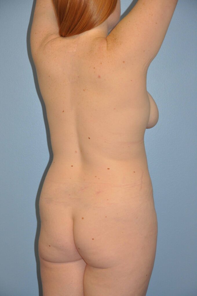 Before Image: Precision BBL #211 - right-back-oblique