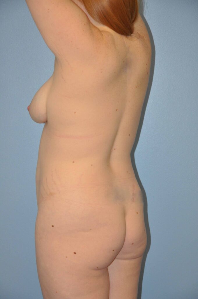 Before Image: Precision BBL #211 - left-back-oblique