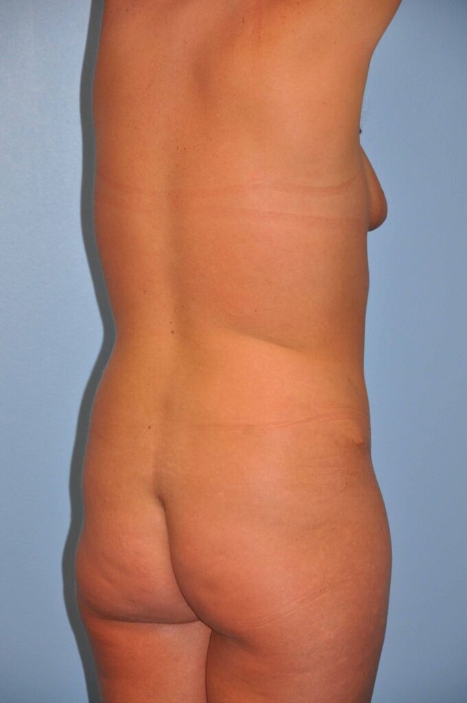 Before Image: Precision BBL #805 - right-back-oblique