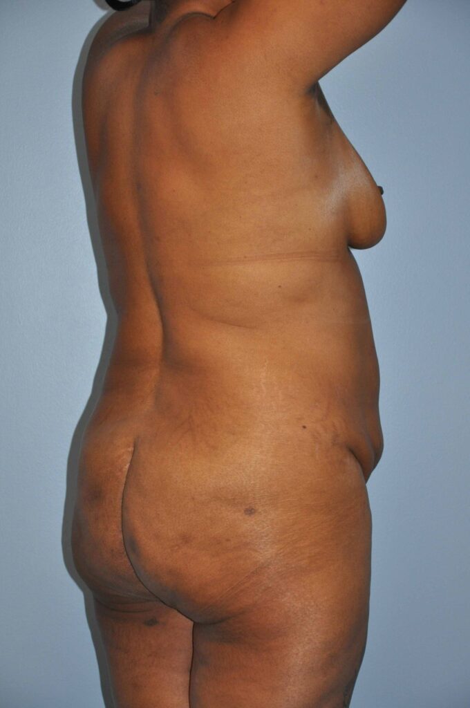 Before Image: Precision BBL #730 - right-back-oblique