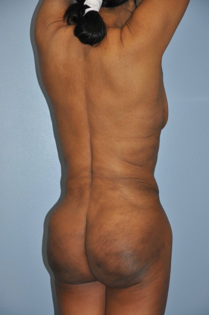 After Image: Precision BBL #981 - right-back-oblique