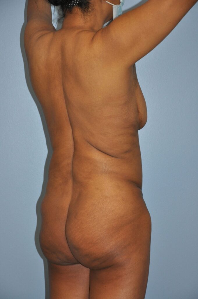 Before Image: Precision BBL #981 - right-back-oblique