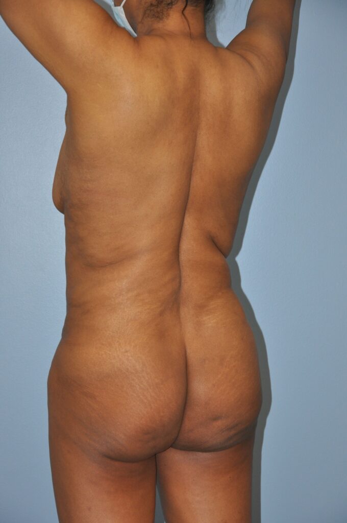 Before Image: Precision BBL #981 - left-back-oblique