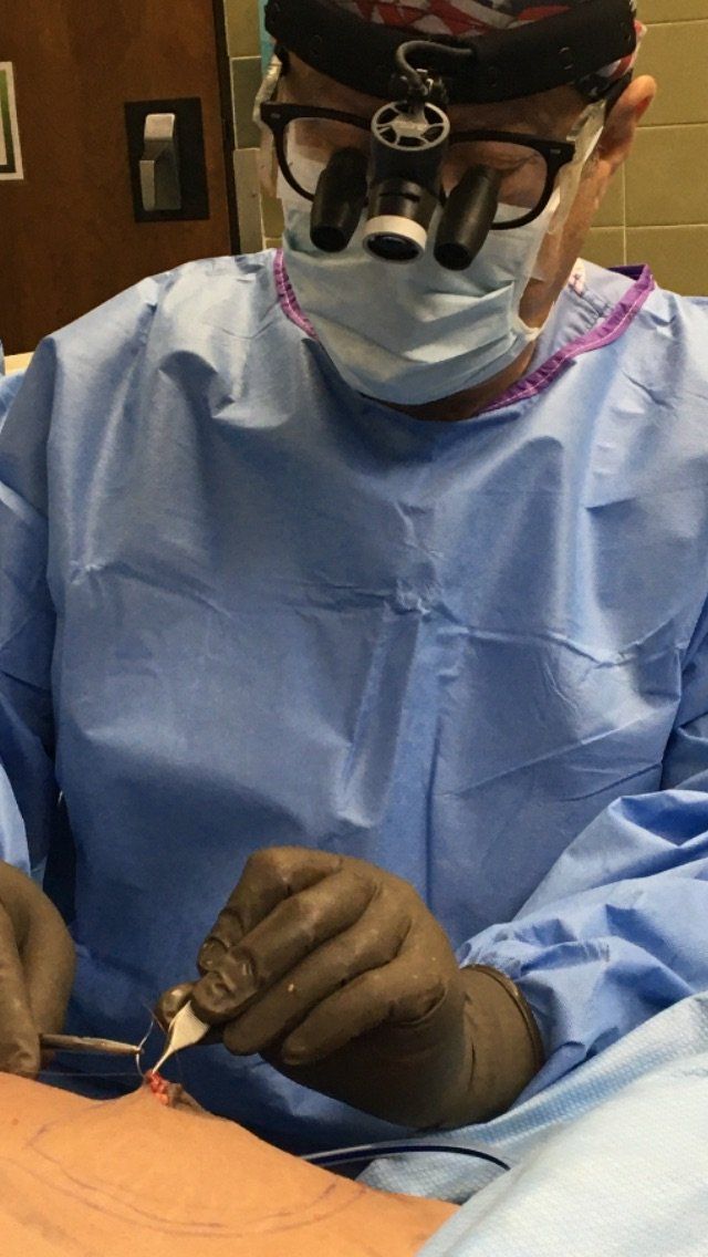 DR ALDEA Man Boob operation