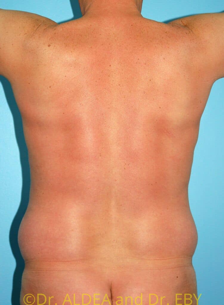 Before Image: Love Handles #458 - back