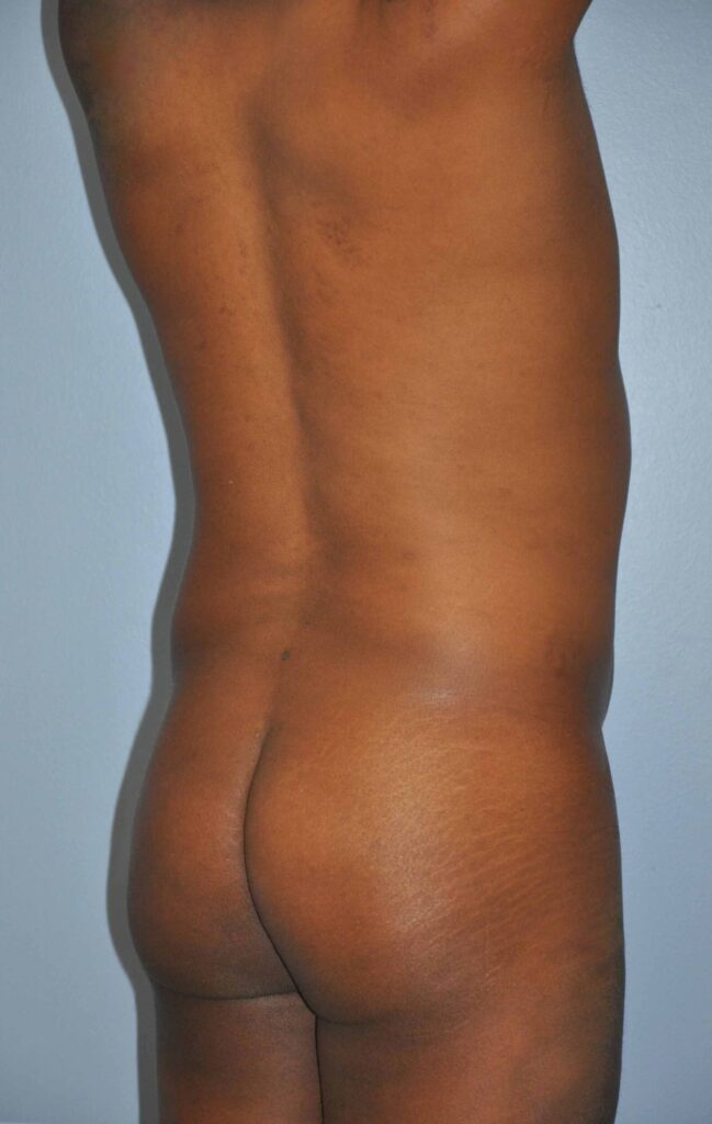 Before Image: Precision BBL #886 - right-back-oblique