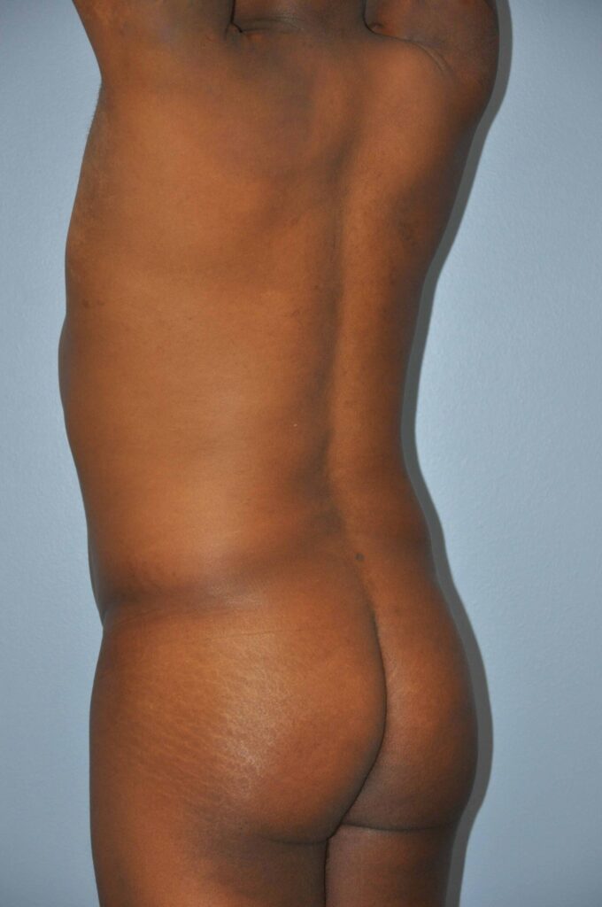 Before Image: Precision BBL #886 - left-back-oblique