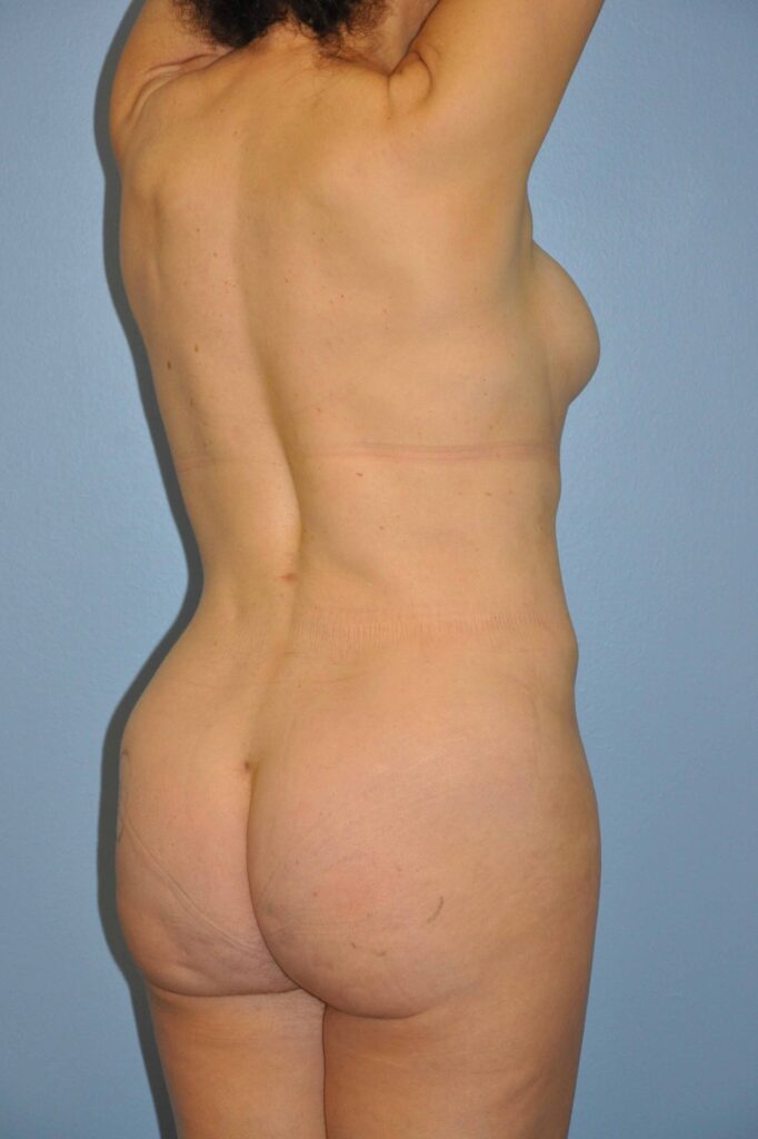 After Image: Precision BBL #376 - right-back-oblique