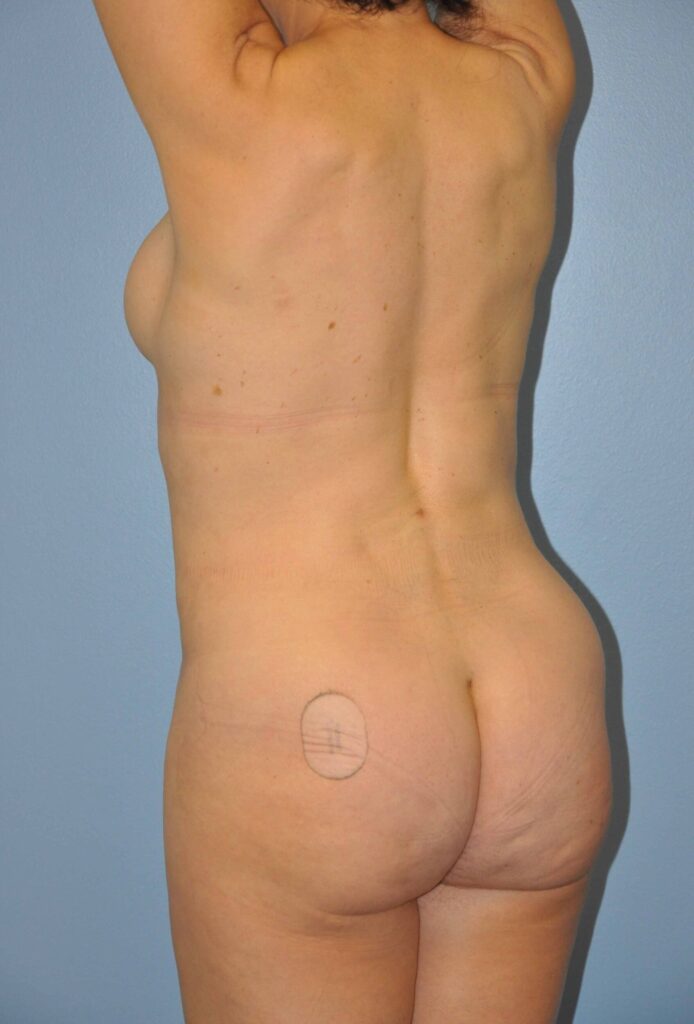 After Image: Precision BBL #376 - left-back-oblique