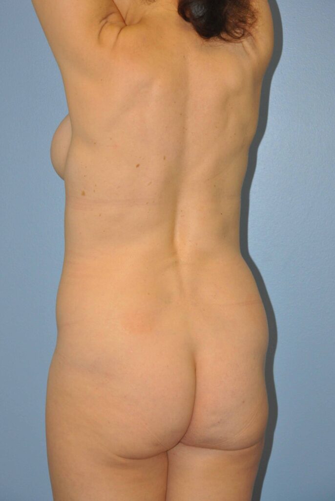 Before Image: Precision BBL #376 - left-back-oblique