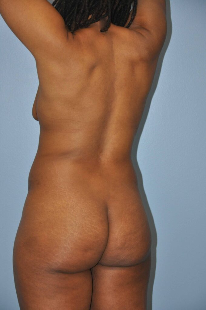 Before Image: Precision BBL #727 - left-back-oblique