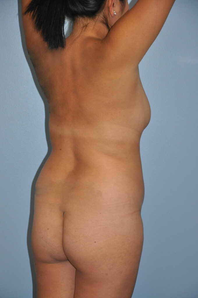 Before Image: Precision BBL #998 - right-back-oblique