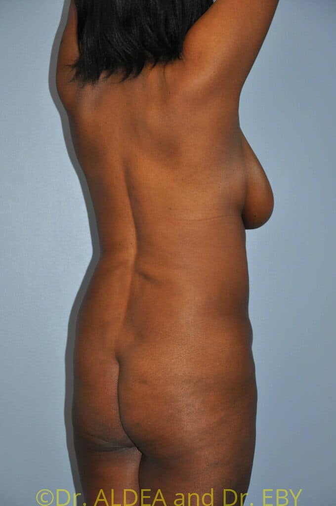 Before Image: Precision BBL #649 - right-back-oblique