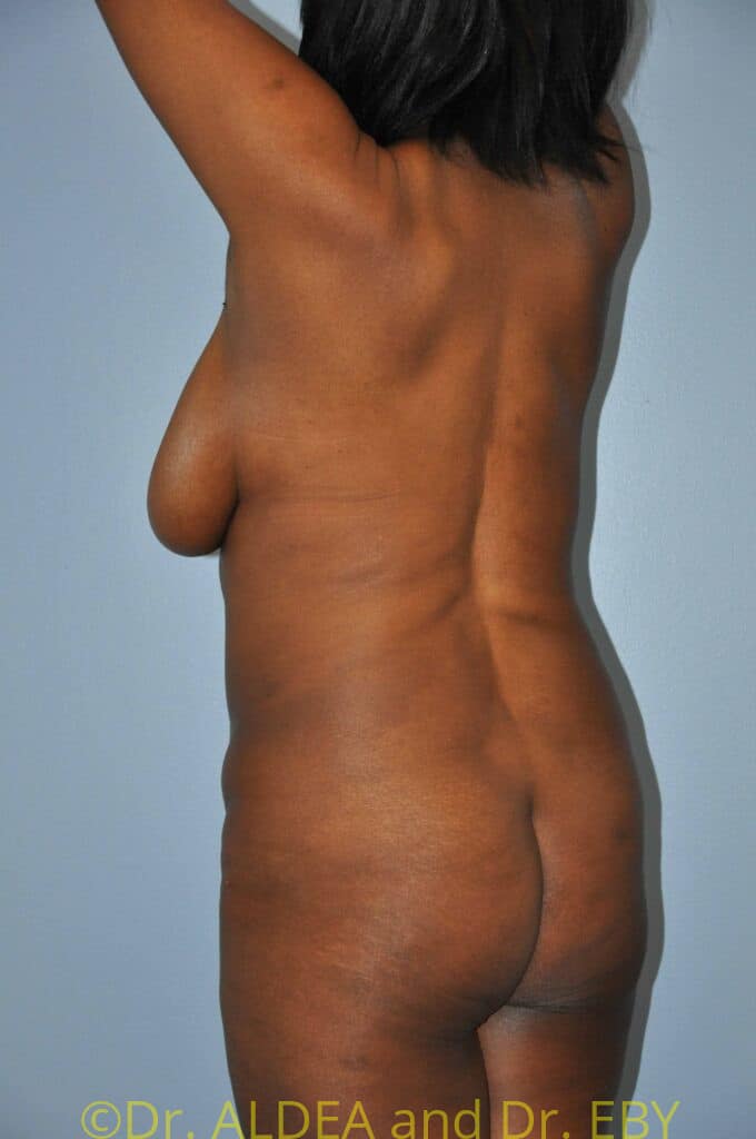 Before Image: Precision BBL #649 - left-back-oblique