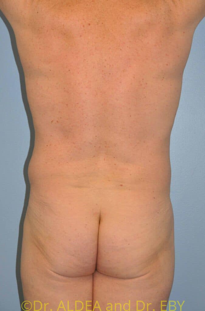 Before Image: Love Handles #526 - back
