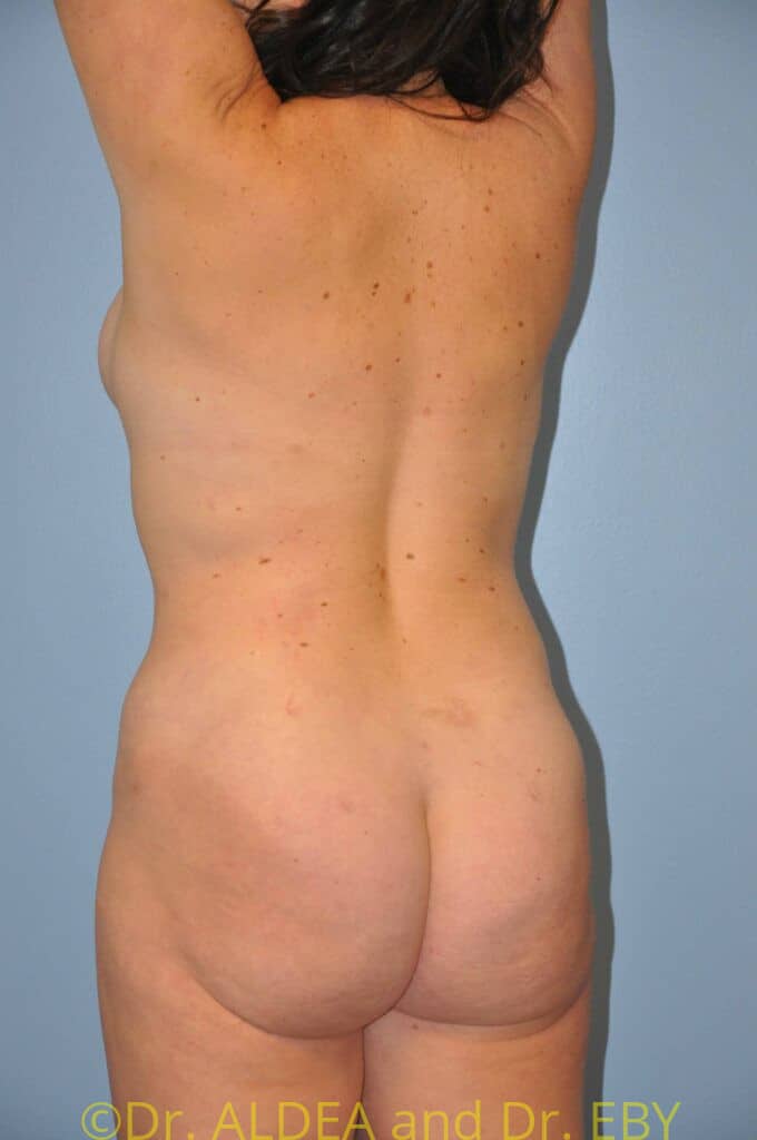 Before Image: Precision BBL #073 - left-back-oblique
