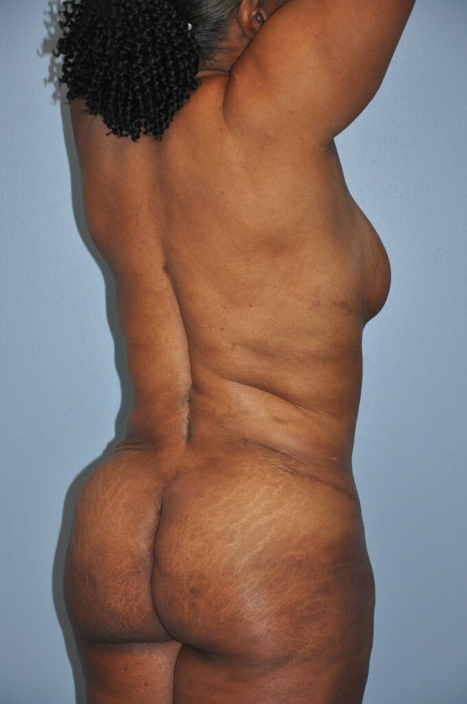 After Image: Precision BBL #278 - right-back-oblique