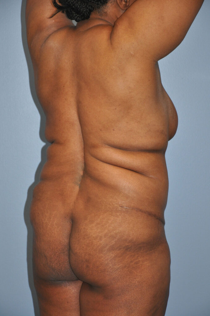 Before Image: Precision BBL #278 - right-back-oblique