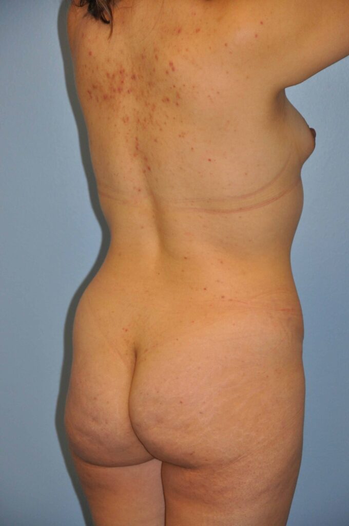 Before Image: Precision BBL #749 - right-back-oblique