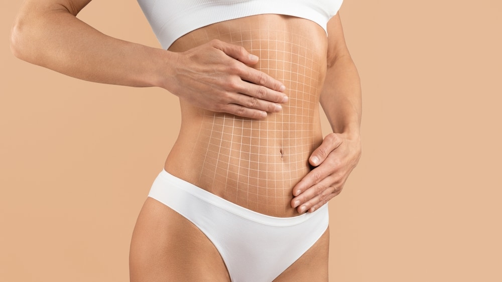 Close up of a young woman touching her smooth, flat stomach after tummy tuck with a grid overlay to show the contours. Close up of a young woman touching her smooth, flat stomach after tummy tuck with a grid overlay to show the contours.
